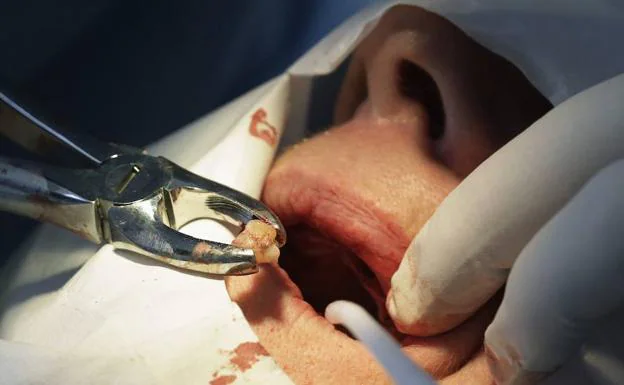 Un odontólogo tendrá que pagar 99.000 euros por dejar sin dientes a una paciente