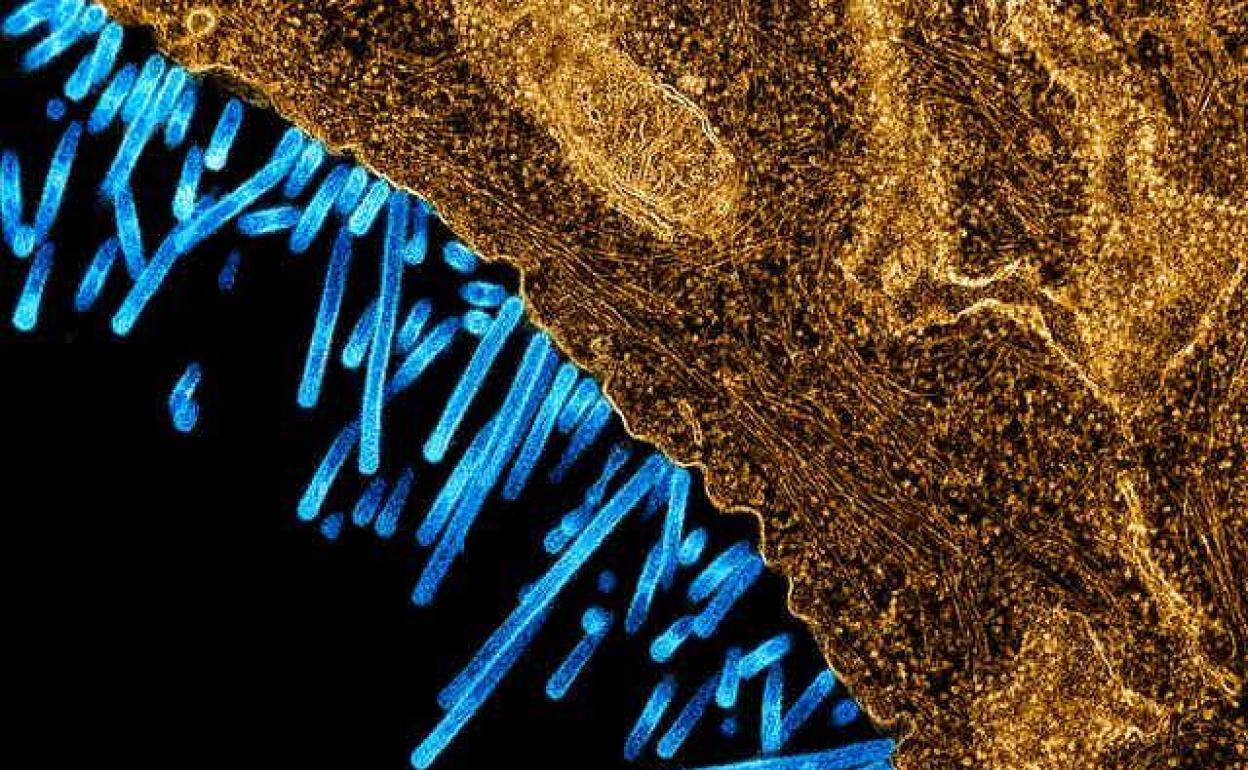 Micrografía electrónica virus de la gripe adheridas a la superficie de una célula. 