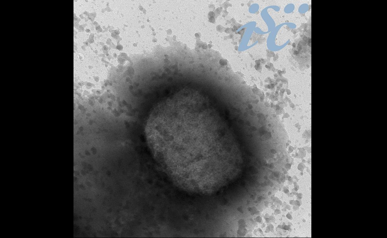 Virus de la viruela del mono por microscopía electrónica, facilitada por el Instituto de Salud Carlos III (ISCIII). 