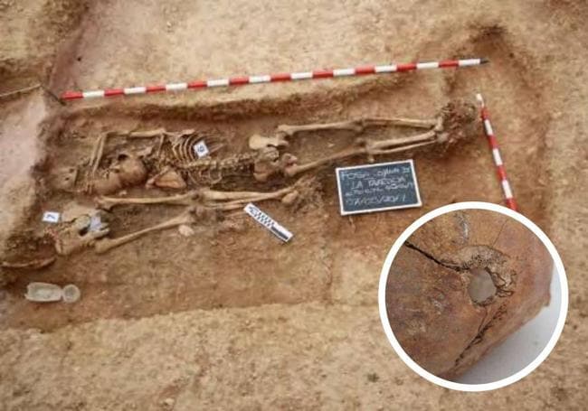 Exhumación en Ibeas de Juarros. En detalle, agujero provocado por arma de fuego encontrado en uno de los restos mortales