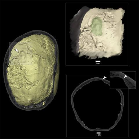 Modelo 3D virtual e imagen de MicroCT del cráneo de la sima de Marcenejas donde se indica la lesión que corresponde al tumor craneal.