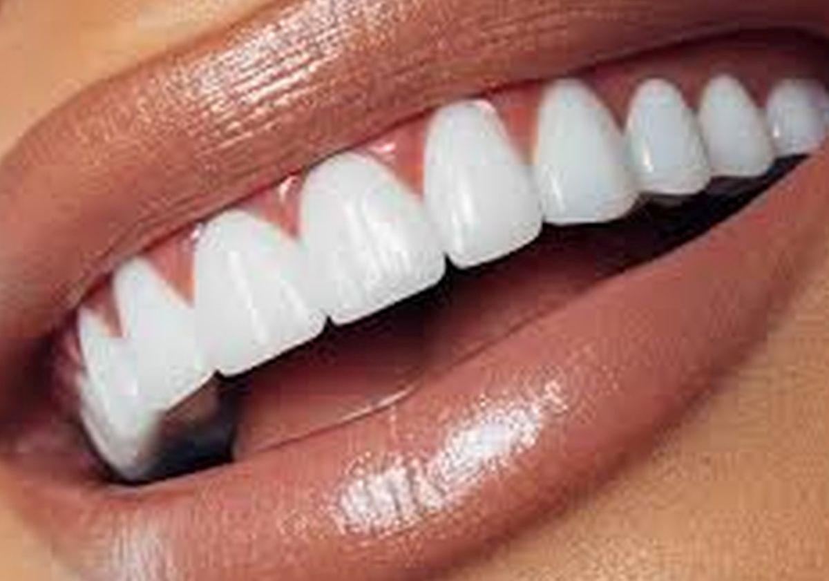 Imagen principal - Consigue la sonrisa perfecta para el verano