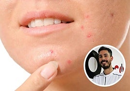 El experto en dermocosmética Alberto León habla sobre los radicales libres y los antioxidantes.