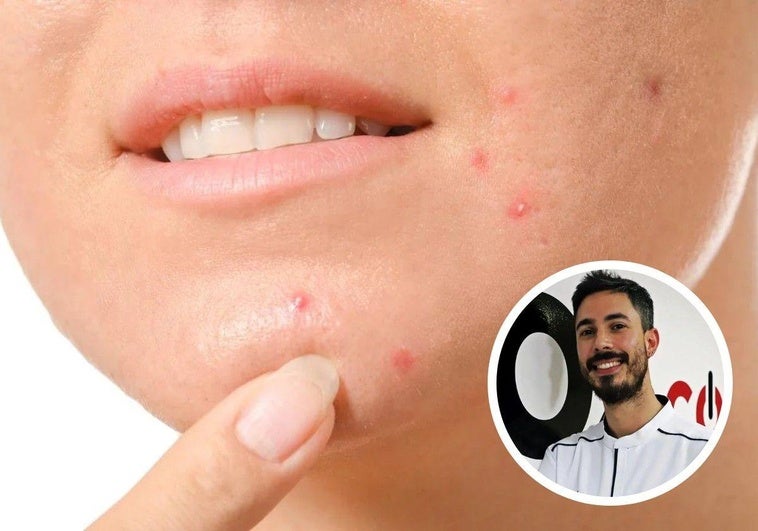 El experto en dermocosmética Alberto León habla sobre los radicales libres y los antioxidantes.