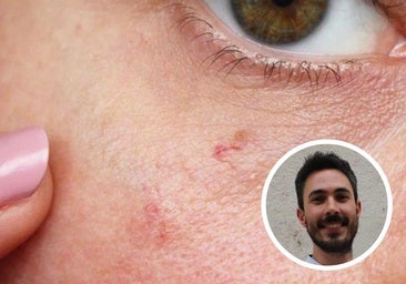 Cómo evitar que salgan manchas en la cara: «La cosmética ayuda a prevenir, controlar y corregir»