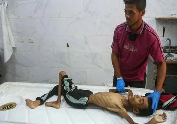 Un hospital de Gaza anuncia que 21 niños murieron de malnutrición y hambre en 72 horas