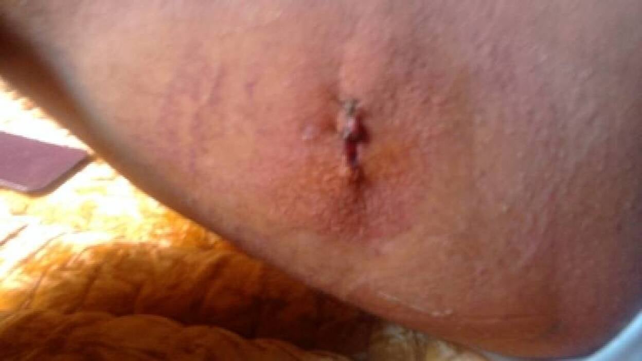 Dos políticos canarios denuncian torturas en el Sáhara