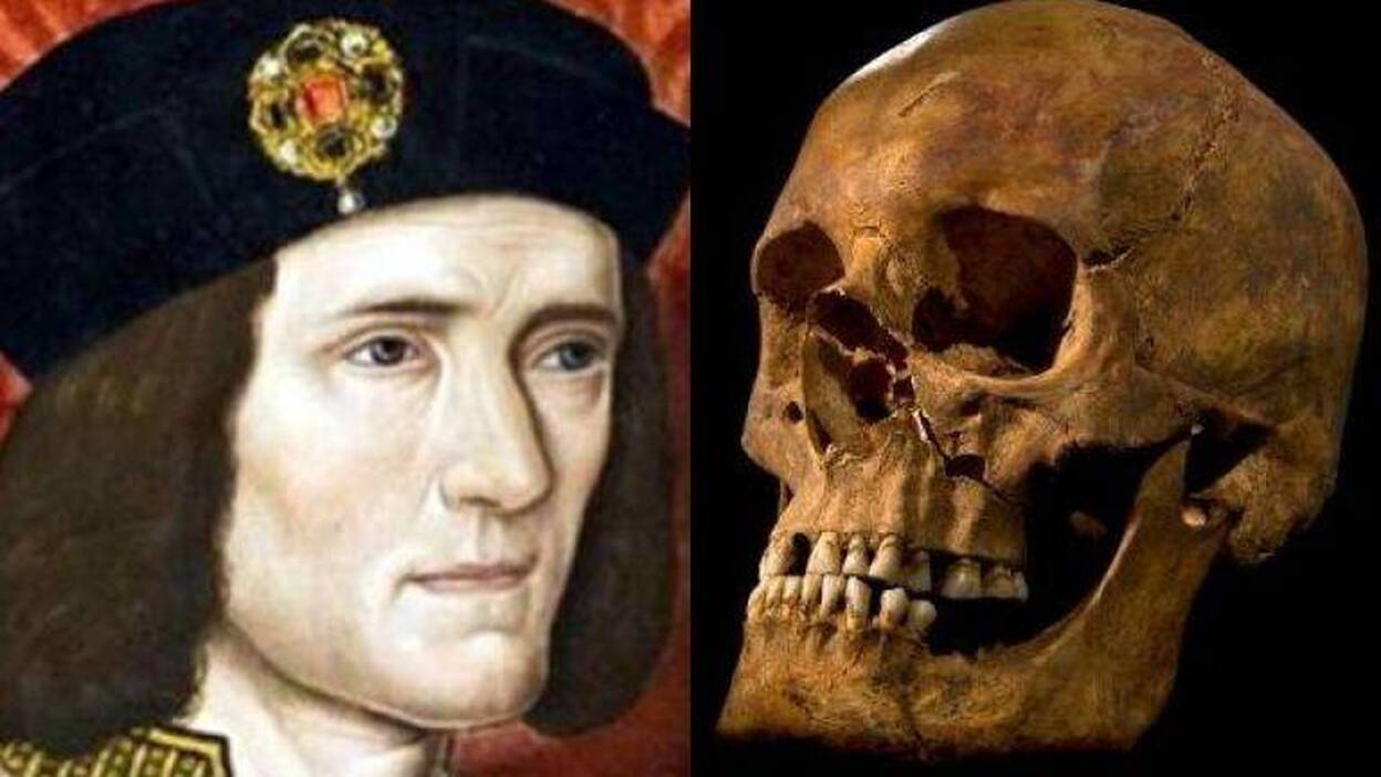 El rey inglés Ricardo III sufrió una infección intestinal