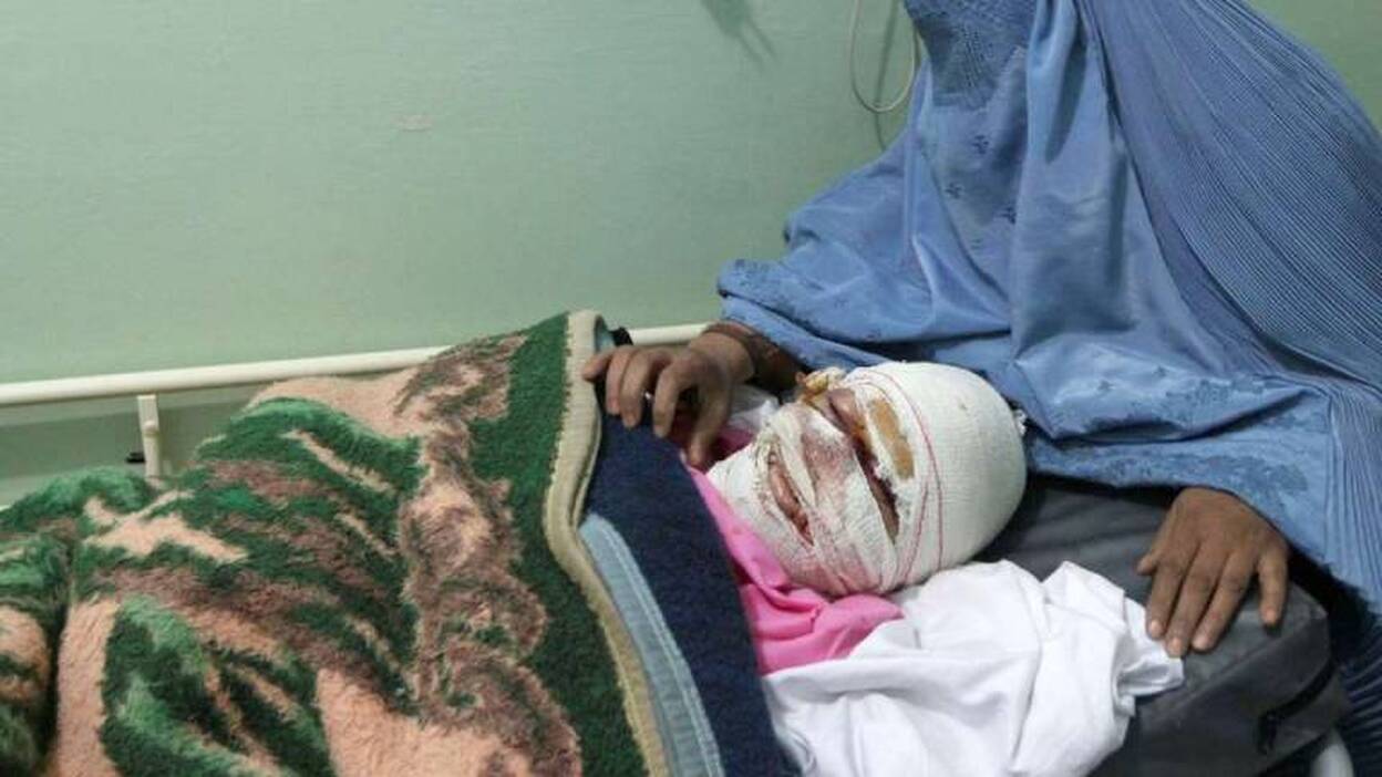Un afgano corta los labios y la nariz a su esposa tras una disputa conyugal