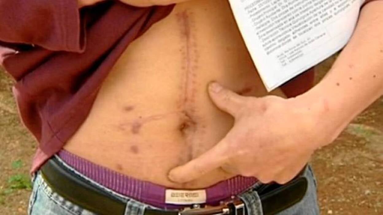 La fiscalía ofrece un pacto al facultativo de las pinzas