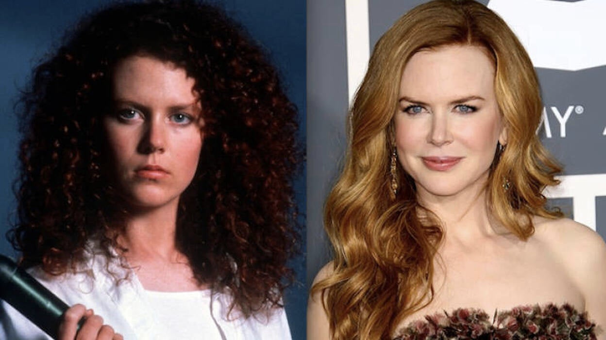 Los retoques estéticos en las famosas se han vuelto progresivos y discretos