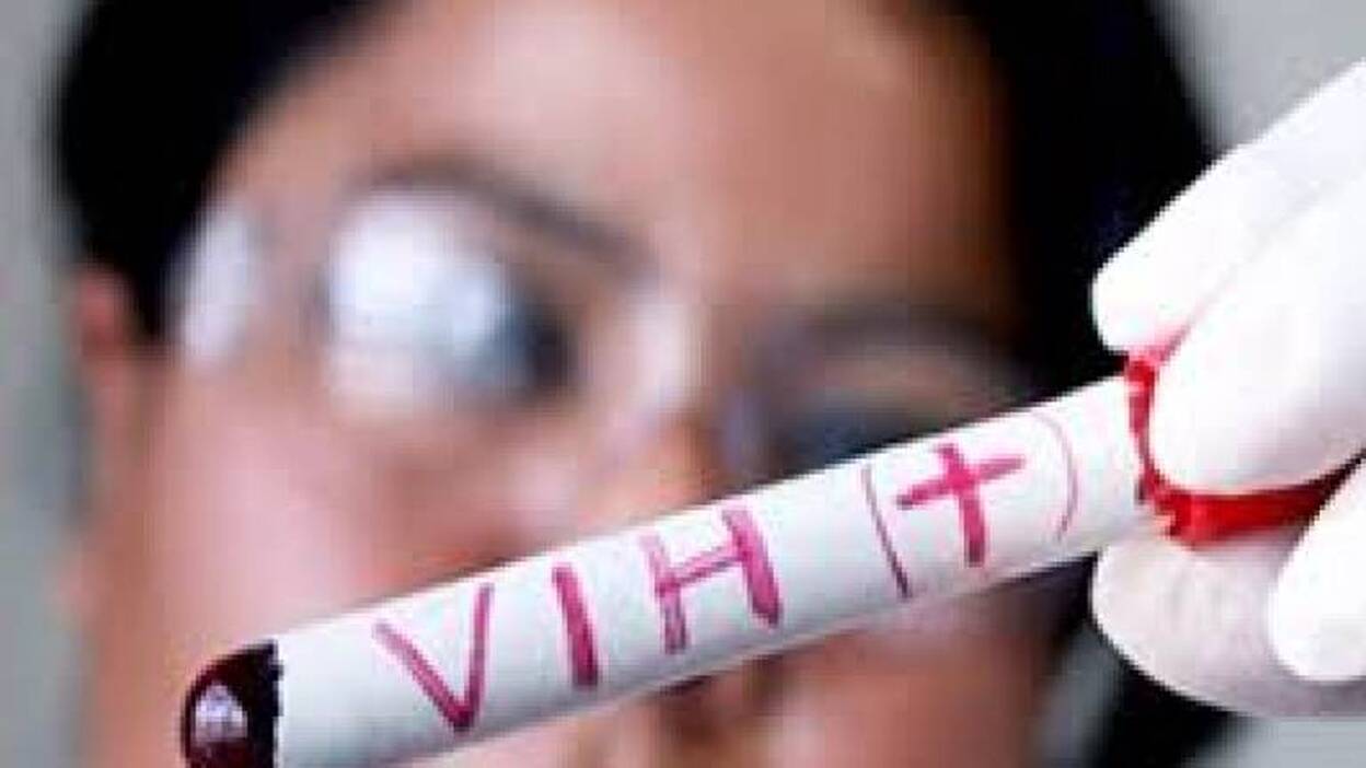 Canarias registra 268 nuevos casos por infección de VIH durante 2015