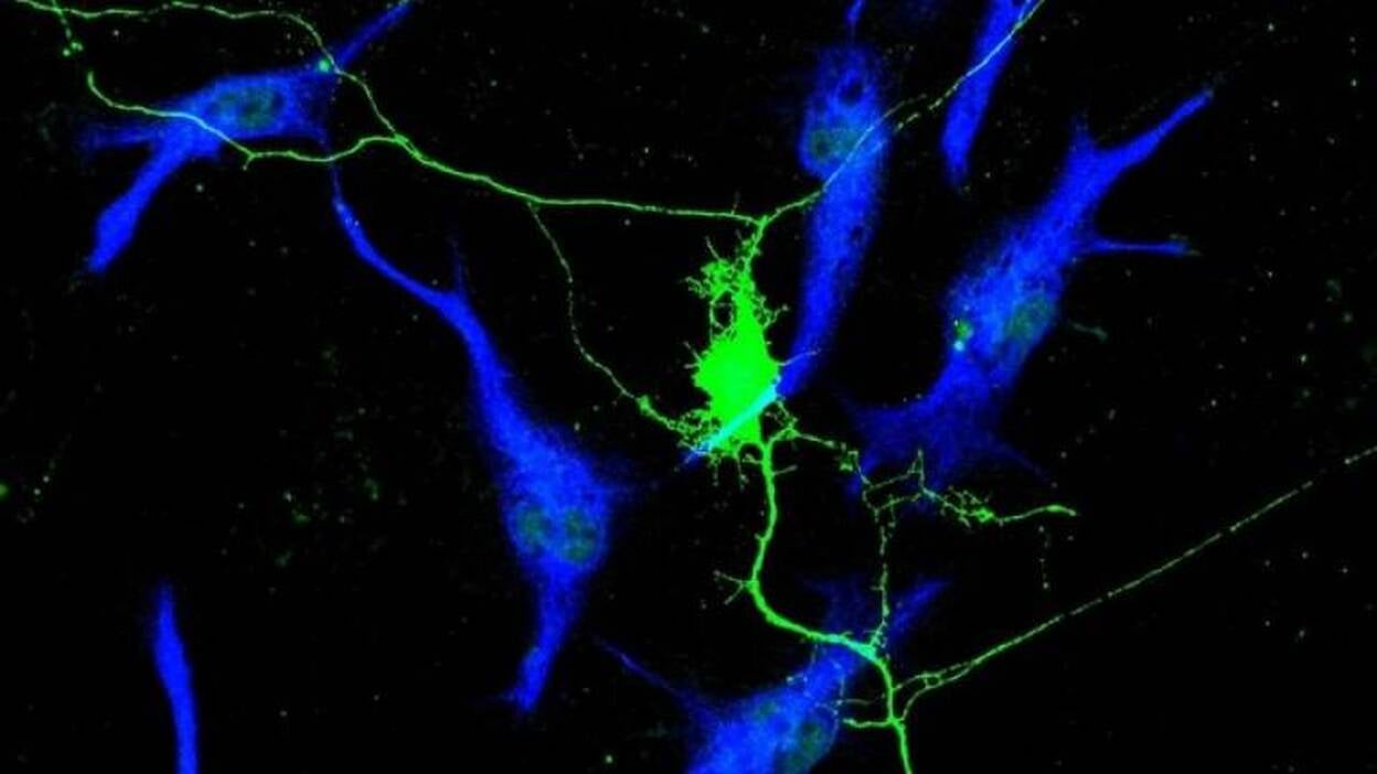 Las neuronas apoyan el crecimiento del cáncer en todo el cuerpo