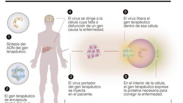 Terapia génica: más cerca de curar enfermedades raras originadas por un único gen