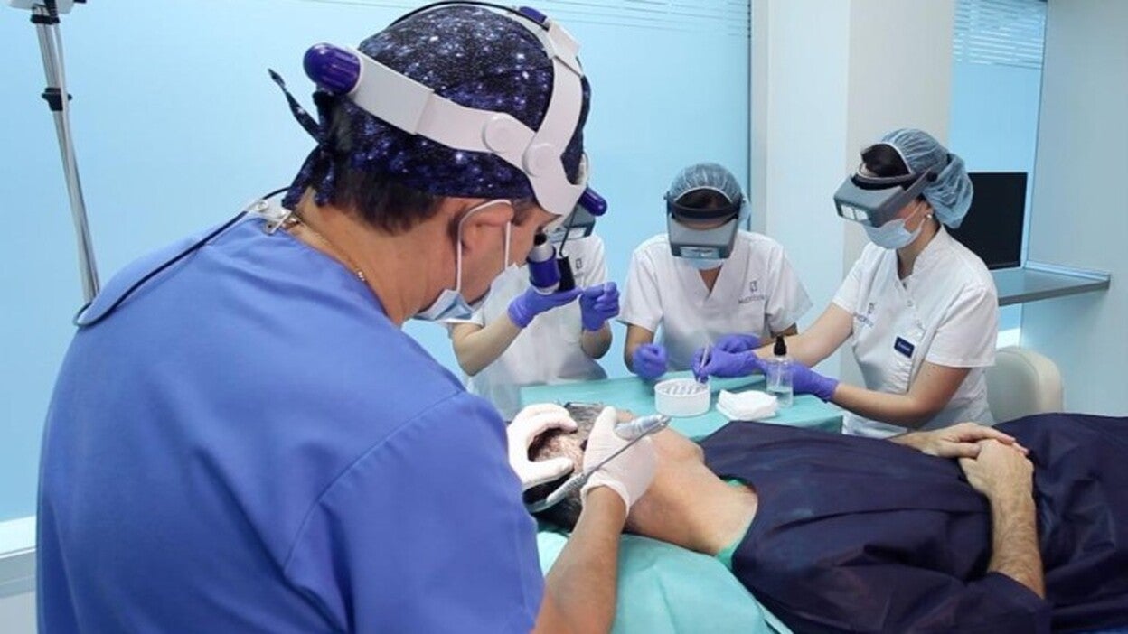 El trasplante capilar, con médicos especializados