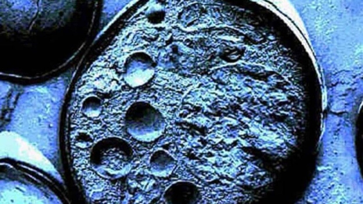 Primeros test clínicos con un fármaco con células iPS