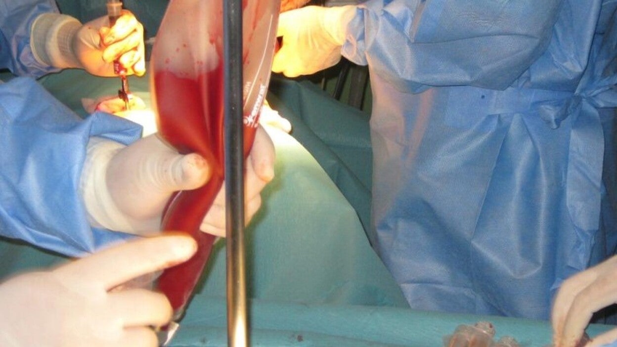 España suma casi 8.000 donantes de médula al mes