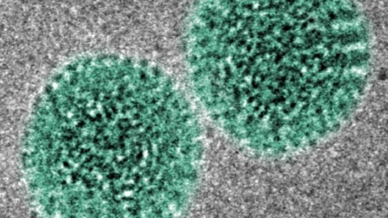 Rotavirus. Descubren las propiedades mecánicas del virus, claves en la infección