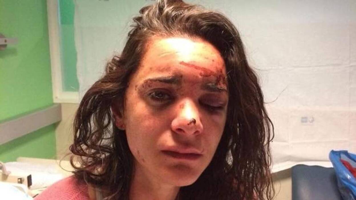 Violan y atacan a una estudiante estadounidense en Aluche