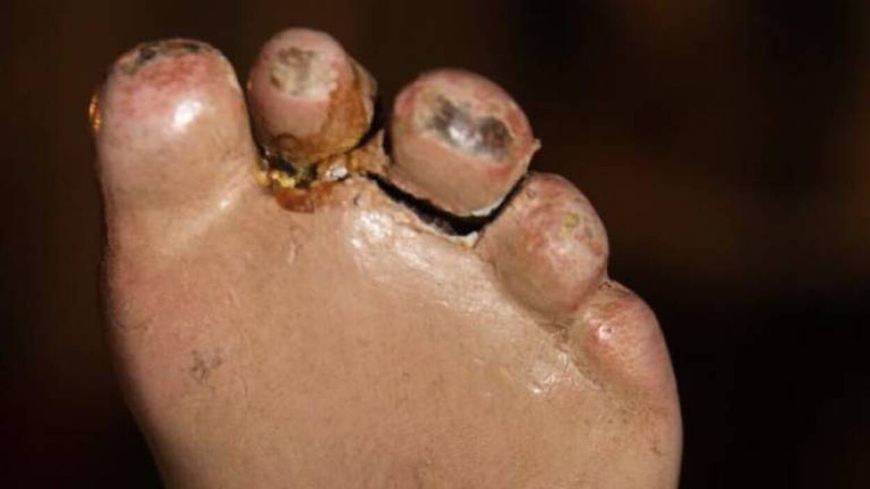 El niño de la Virgen de La Luz se daña en una caída