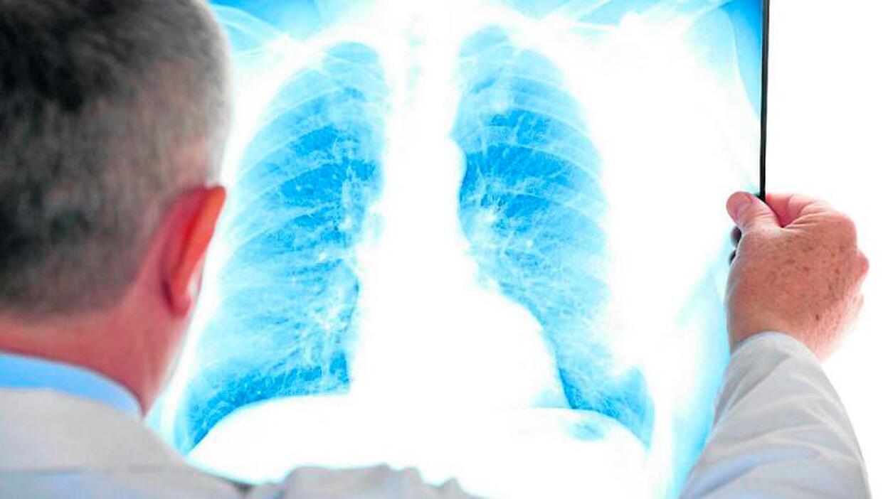 Decodifican por primera vez una parte clave del sistema inmunológico humano