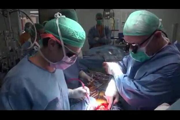 El Hospital de Bellvitge implanta un corazón artificial total