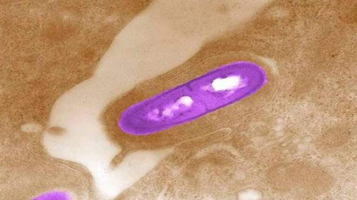 ¿Qué es la listeriosis? Sus síntomas