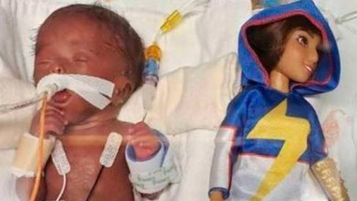 Sobrevive una niña más pequeña que una barbie