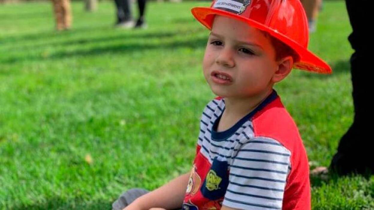 Muere atacado por un pitbull