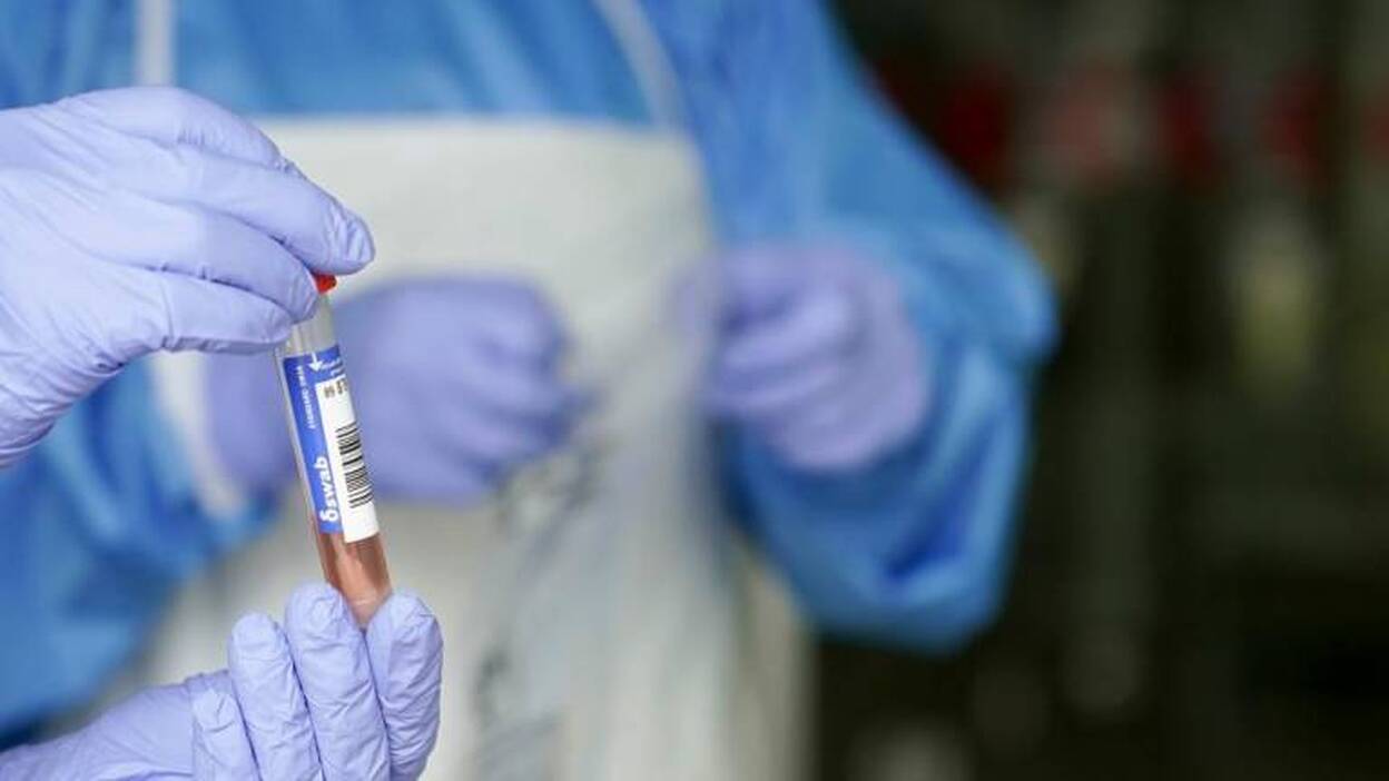 España ha realizado más de 2,5 millones de PCR desde el inicio de la epidemia