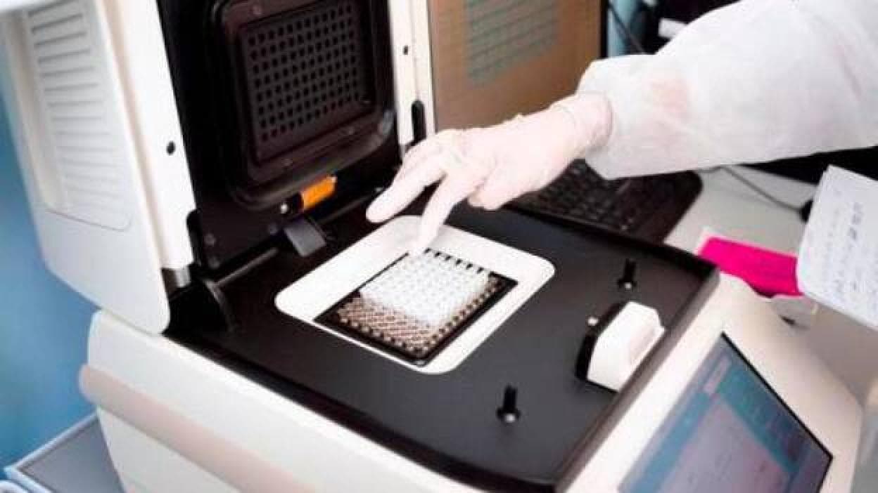 Sanidad admite errores en la compra de máquinas para hacer PCR