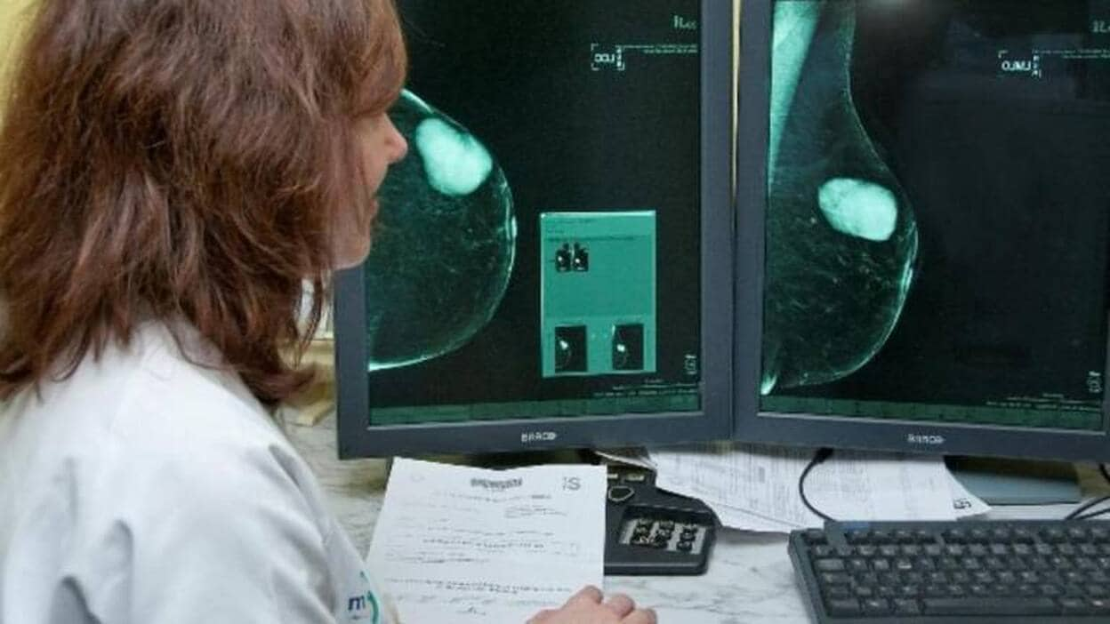 El 29% de las canarias de 50 a 69 años no acude a las mamografías 