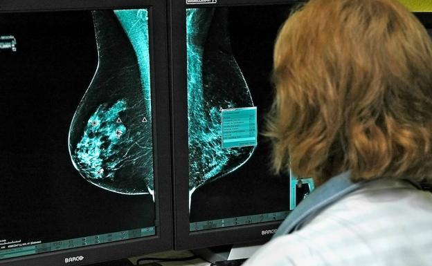 Identifican un modelo matemático para pronosticar los cánceres de mama y pulmón  