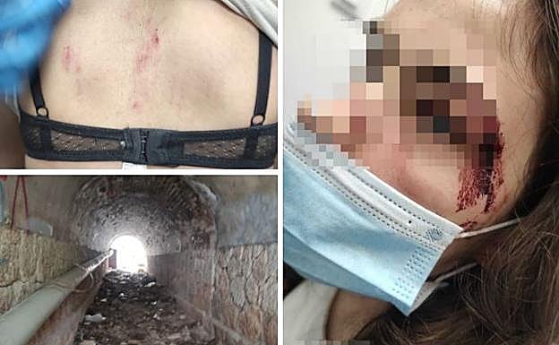 Detenido por dar una paliza a su exnovia de 16 años en Málaga