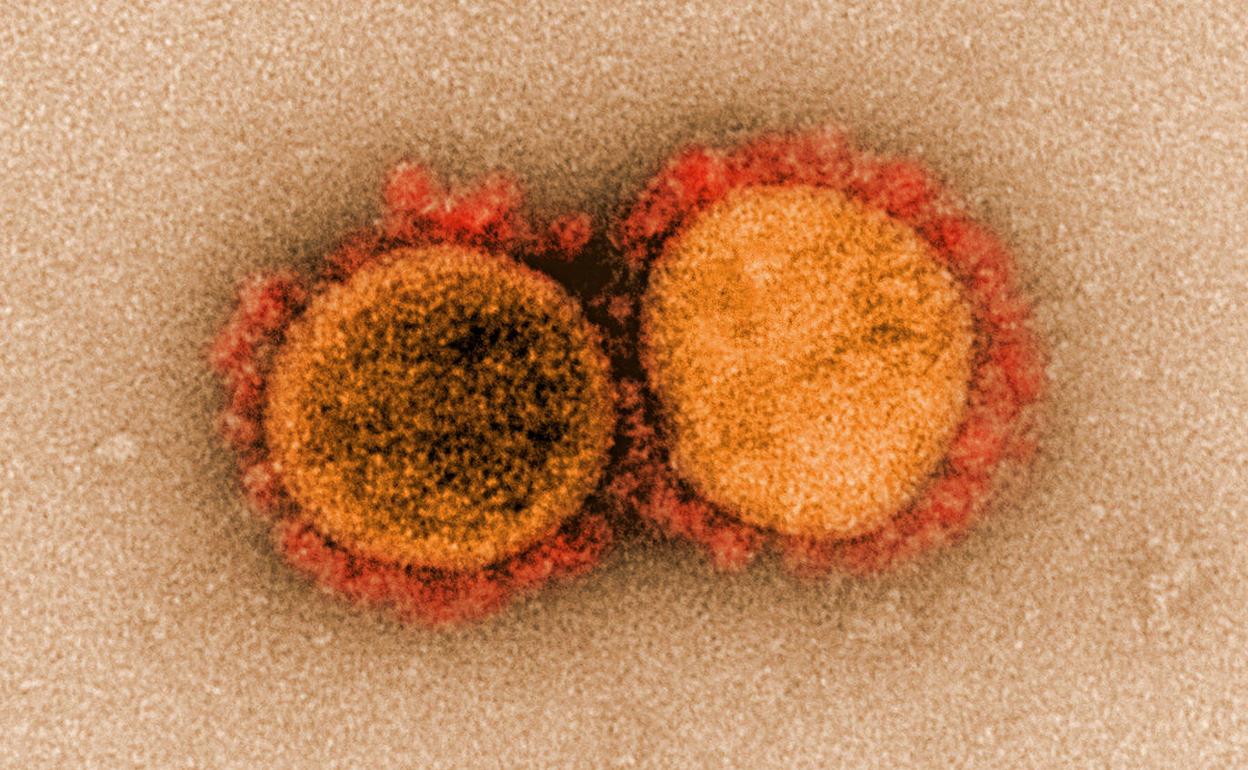 Imagen del coronavirus SARS-CoV-2, causante de la covid.