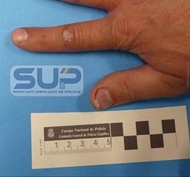 Imagen del SUP de uno de los policías atacado por perros en Canarias en una actuación contra el narcotráfico.