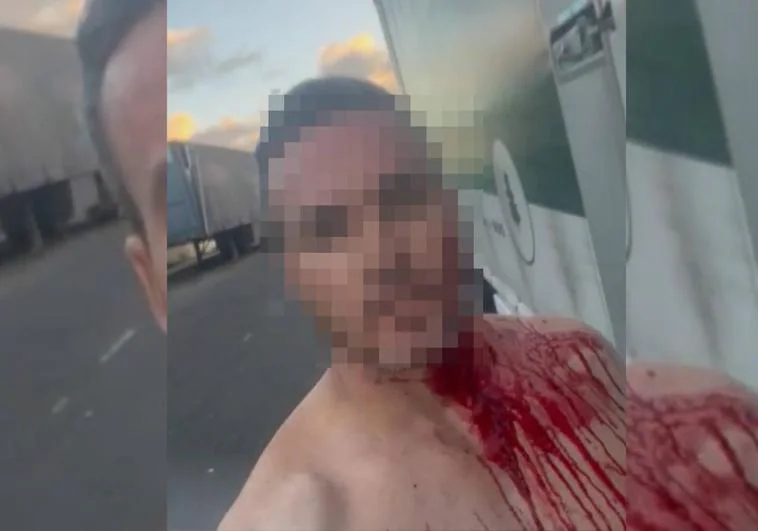 Imagen de la persona herida tras recibir una agresión con un cúter en la capital grancanaria.