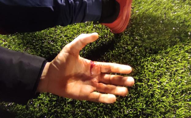 El técnico del Firgas espera que se tomen medidas para erradicar la violencia