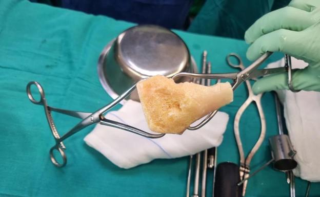Primera cirugía en Lanzarote con injerto de hueso