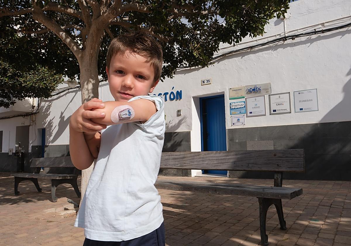 El niño de cuatro años enseña su sensor de la glucemia.