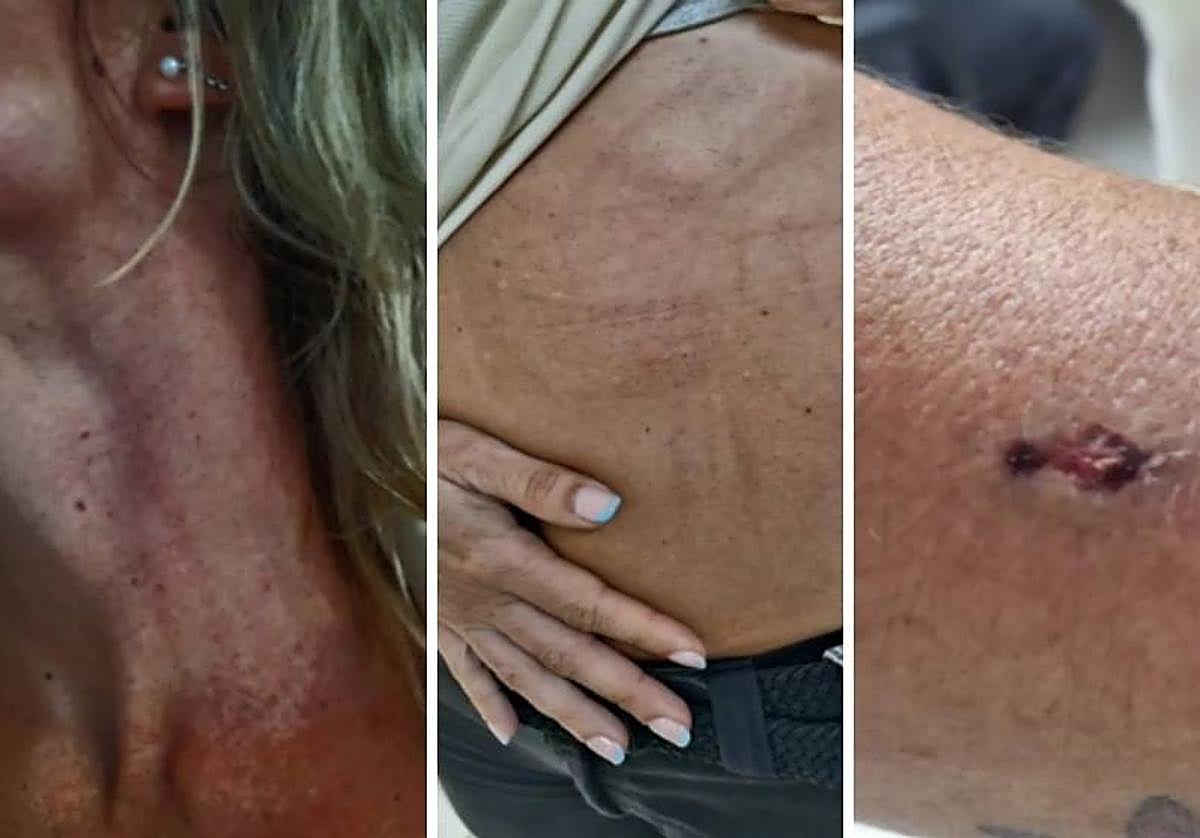 Una de las trabajadoras agredidas.