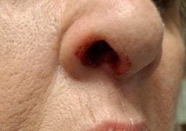 La afectada sufrió heridas en la nariz.