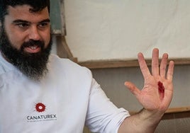 Javier Castillo muestra el tinte rojo en la palma de su mano tras escachar una cochinilla