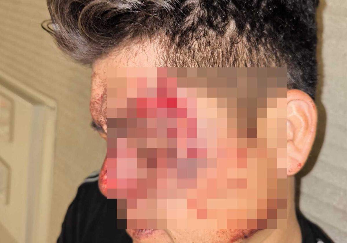 Dos jóvenes asaltan, pegan y roban a un hombre en Las Palmas de Gran Canaria