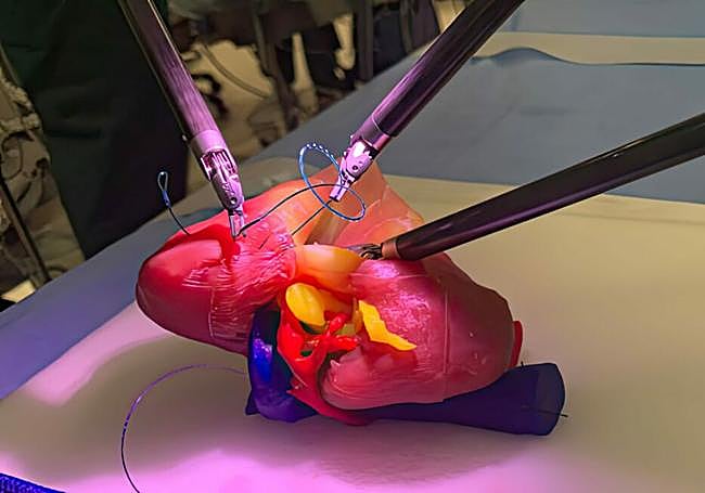 Imagen de la simulación de intervenciones imprensiones 3D.