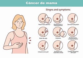 Concepto de cáncer de mama y sus síntomas.