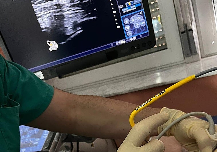 El hospital La Candelaria aplica una técnica pionera contra el cáncer de mama en pacientes que no pueden operarse