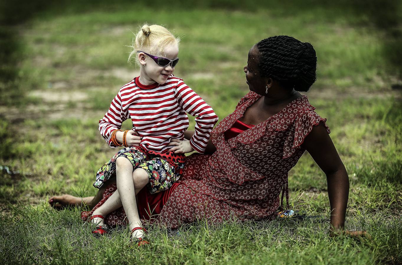 El drama de los albinos de Tanzania