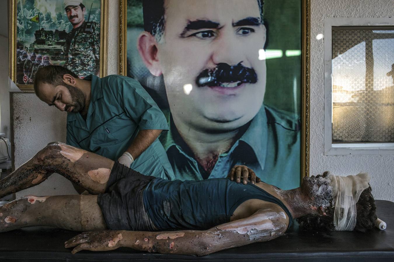 Ganadora del premio de la categoría individual de noticias de actualidad. Un doctor atiende en un hospital de Siria a un joven de 16 años, miembro del grupo terrorista autoproclamado Estado Islámico, frente a un poster con el rostro Abdullah Öcalan, el presidente del Partido de los Trabajadores de Kurdistán.