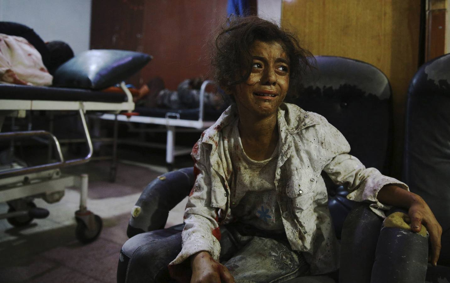 Foto ganadora del segundo premio de 'temas de actualidad'. La fotografía muestra a una niña siria llorando en un hospital de Douma, al este de Damasco (Siria) el 12 de agosto de 2015.